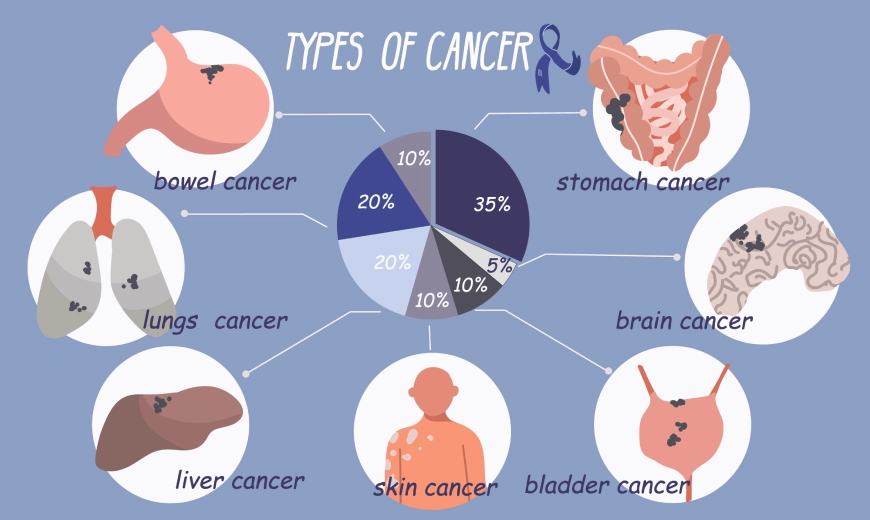 Types of Cancer