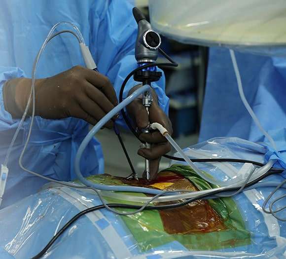Endoscopic Spine Surgery