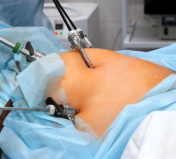General & Laparoscopic Surgery