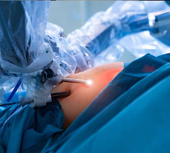 General & Laparoscopic Surgery