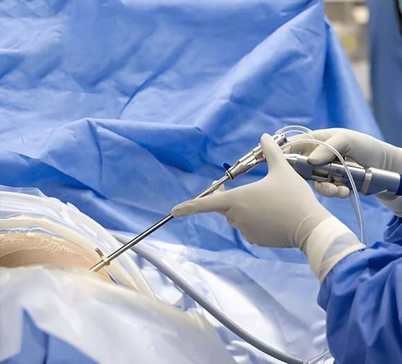 Spine Surgery