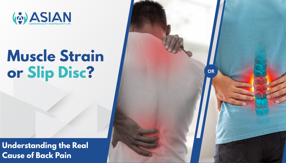 Muscle Strain